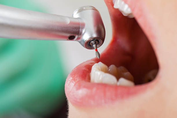 Best Root Canal Emergency Dentist  in Conway, AR